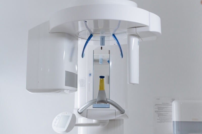 white with blue parts x-ray machine
