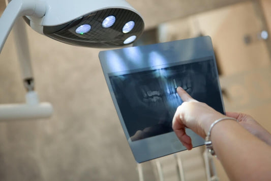pointing finger at dental x-ray results
